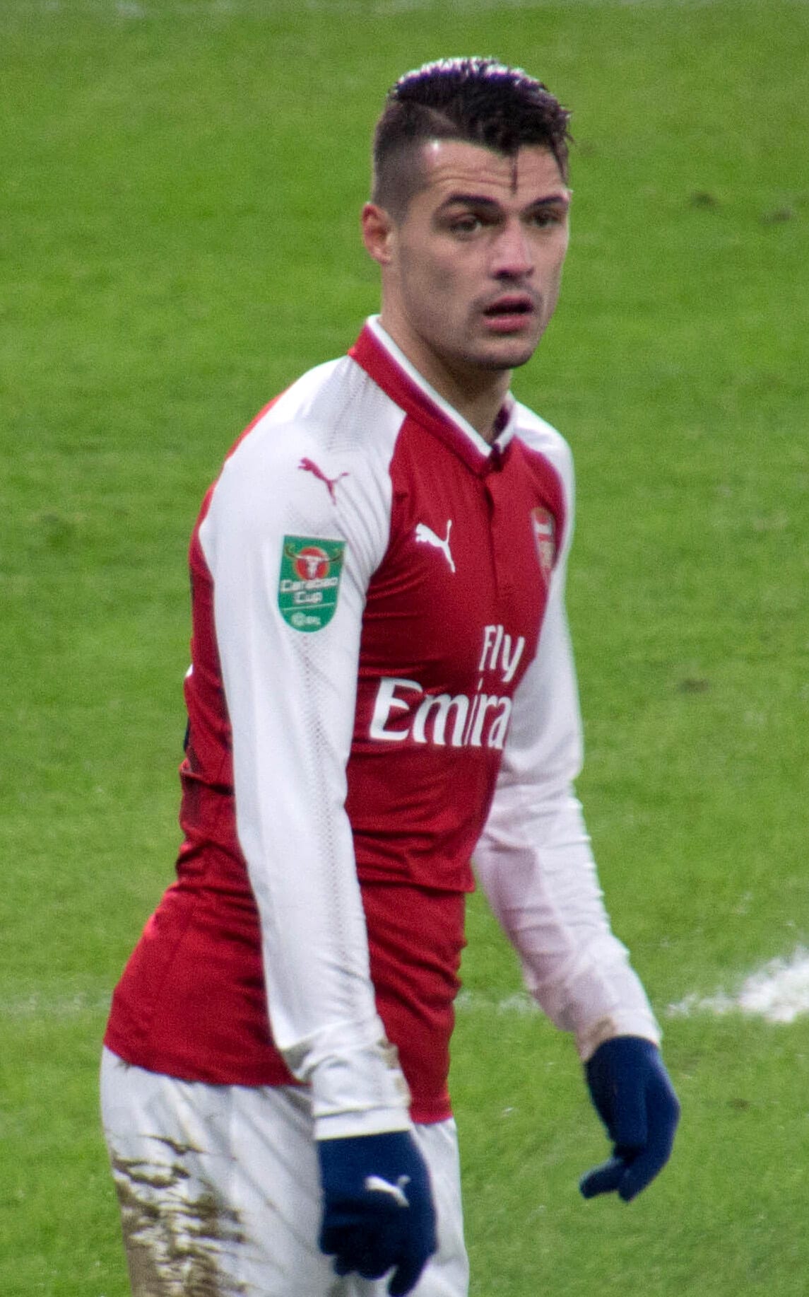 Granit Xhaka - Athlete hair transplant