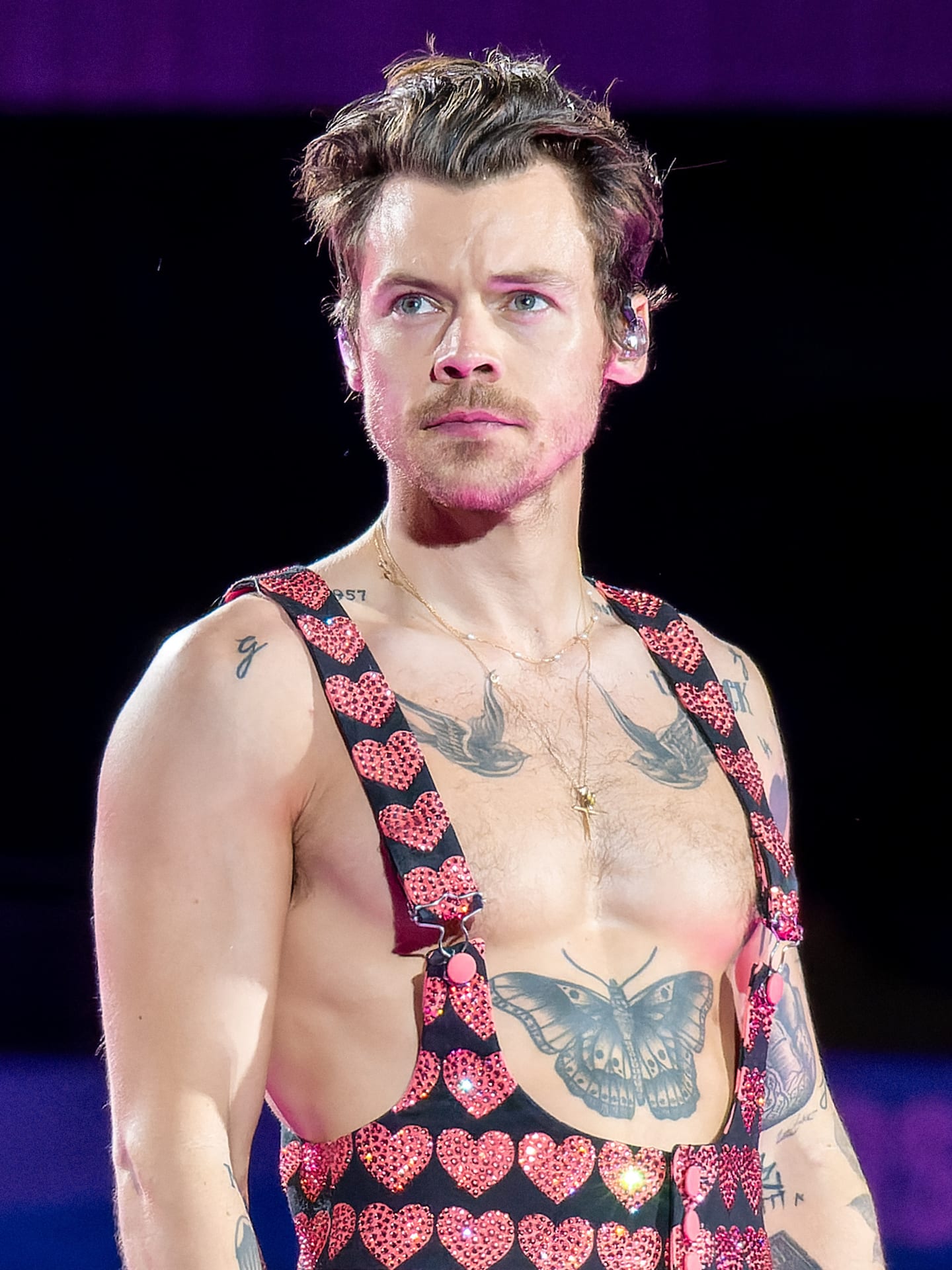 Harry Styles - Musician hair transplant