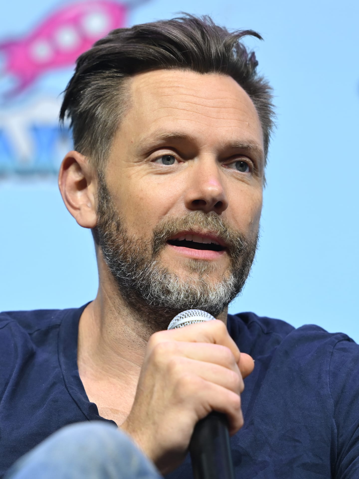 Joel McHale - Actor hair transplant