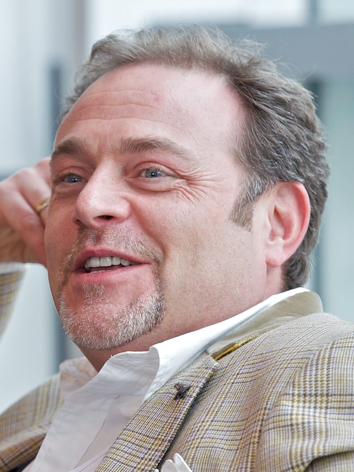 John Thomson - Actor hair transplant