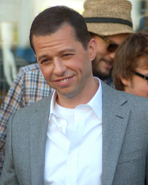 Jon Cryer - Actor hair transplant