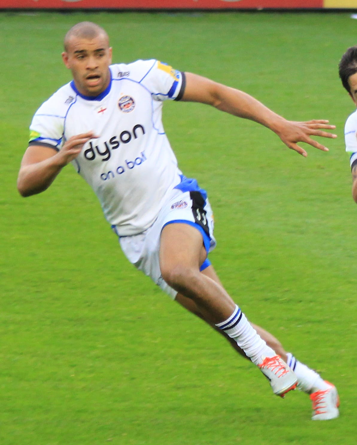 Jonathan Joseph - Athlete hair transplant
