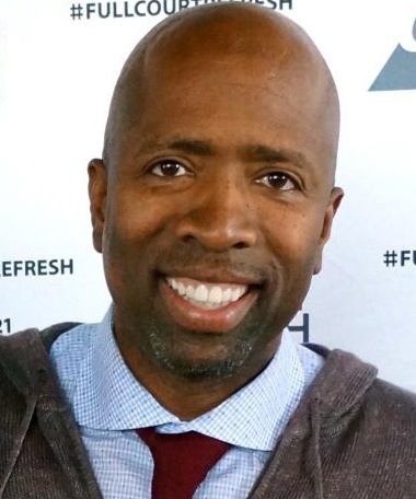 Kenny Smith - Athlete hair transplant