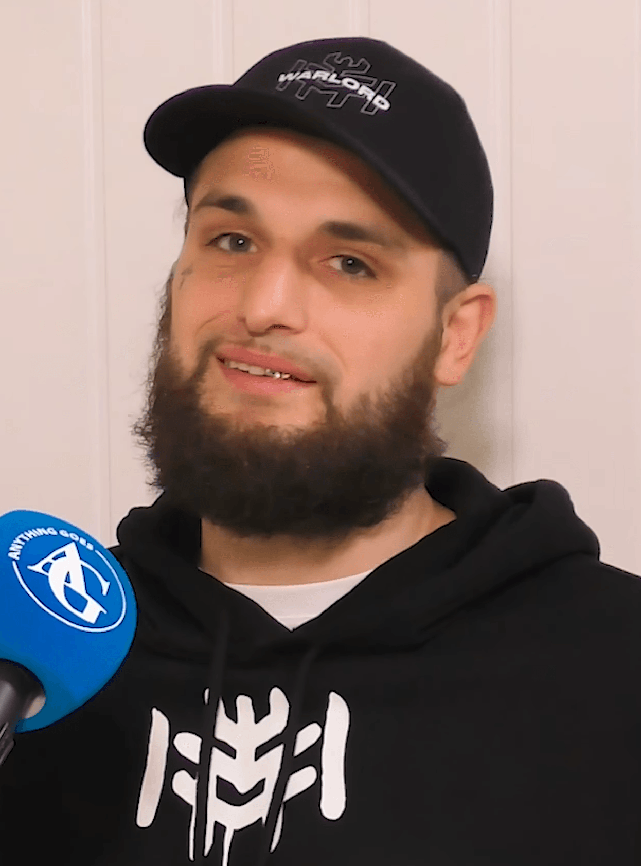 Liam Cameron - Athlete hair transplant