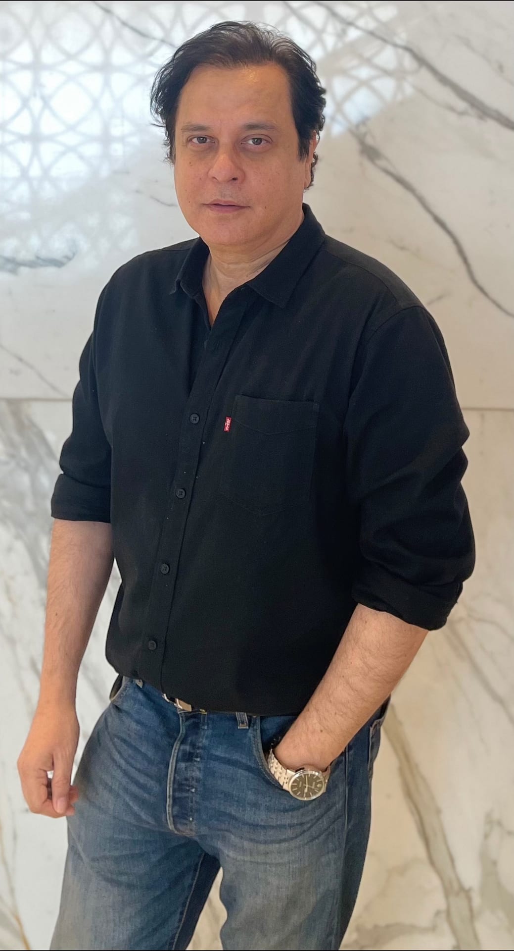 Mahesh Thakur - Actor hair transplant