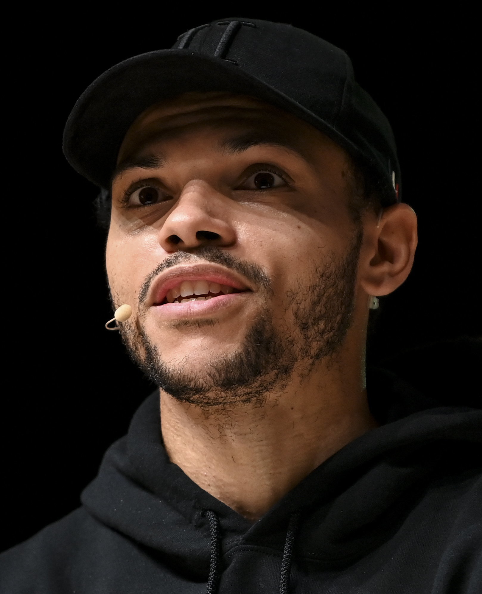 Martin Braithwaite - Athlete hair transplant