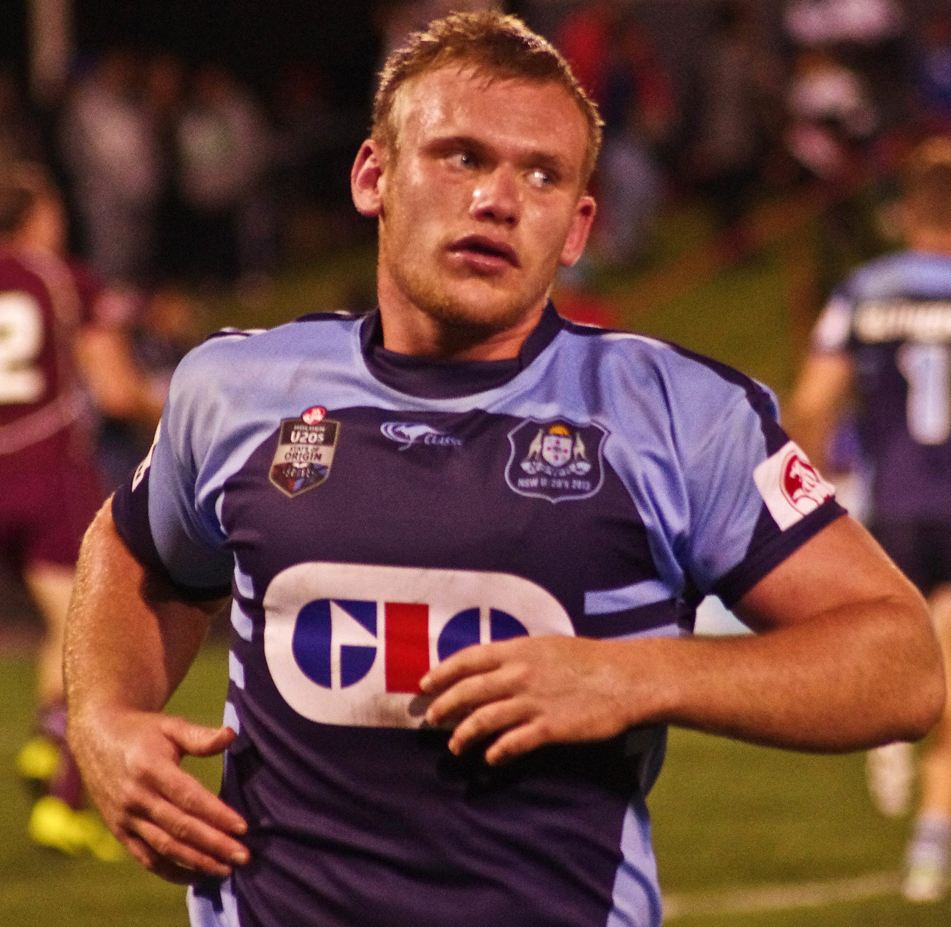 Matt Lodge - Athlete hair transplant