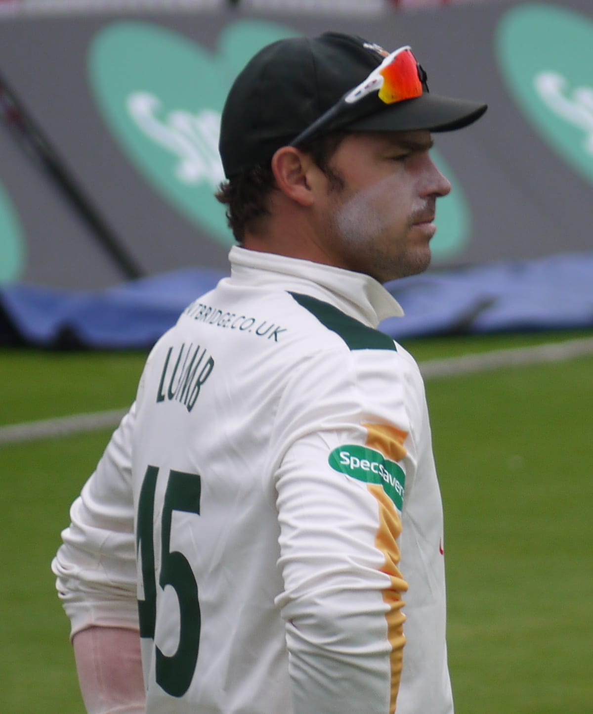 Michael Lumb - Athlete hair transplant