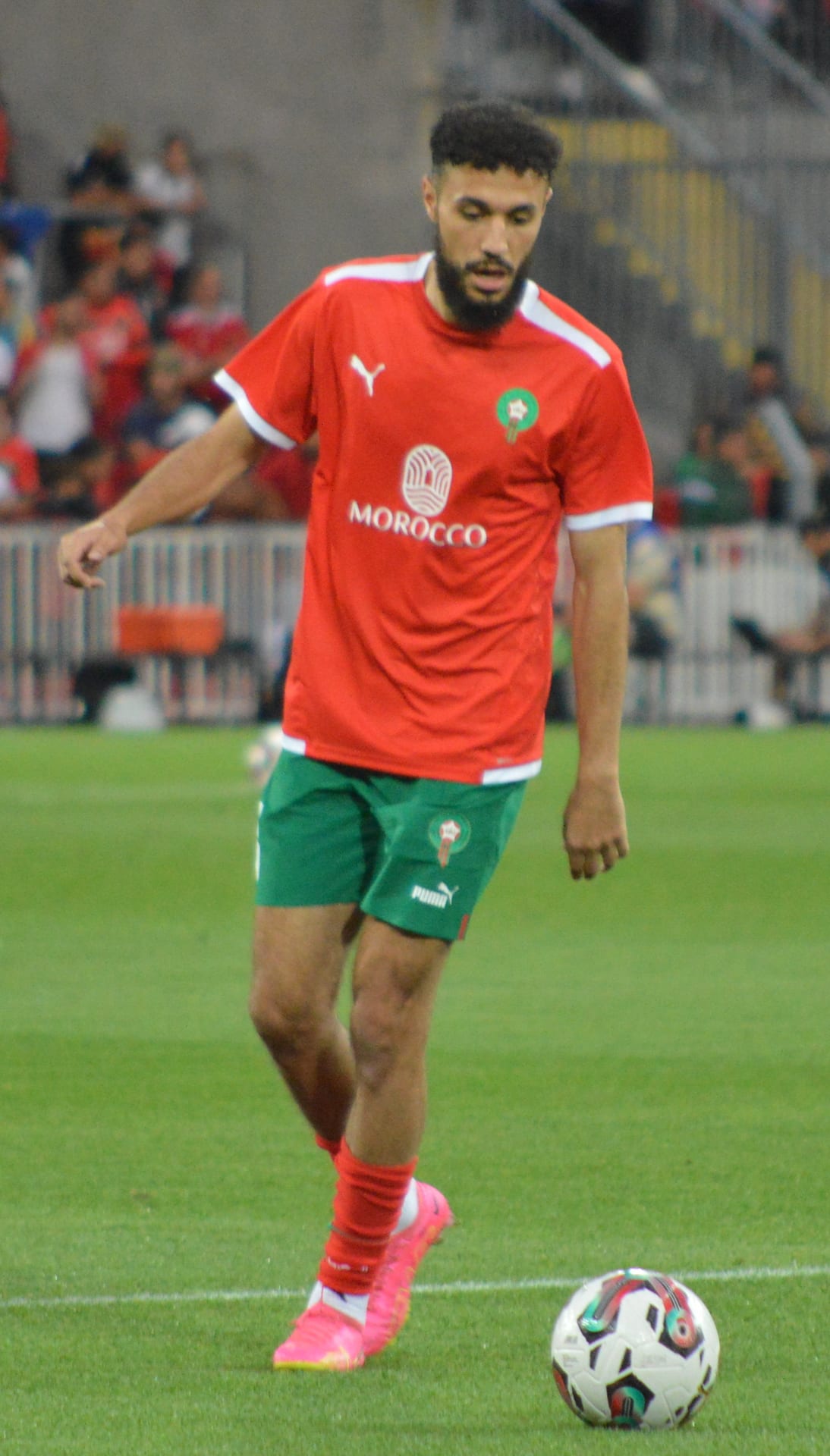 Noussair Mazraoui - Athlete hair transplant