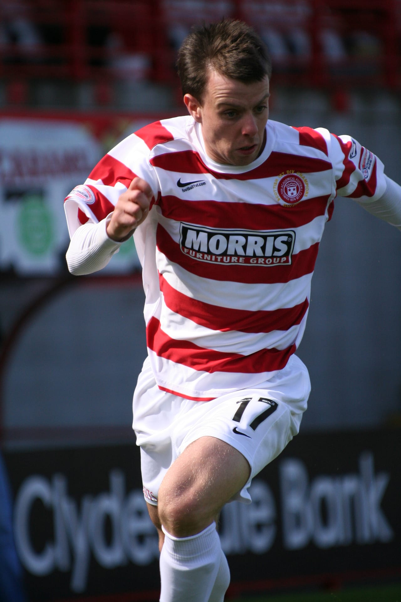 Paul McGowan - Athlete hair transplant