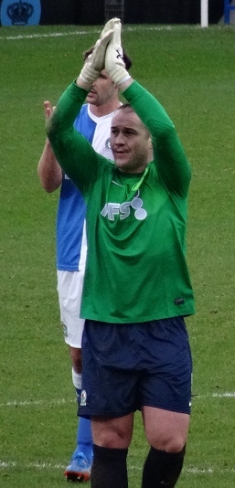 Paul Robinson - Athlete hair transplant