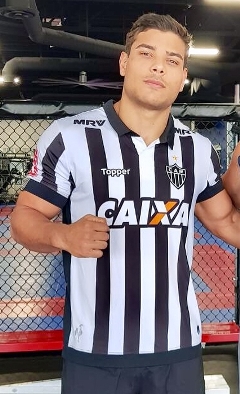 Paulo Costa - Athlete hair transplant