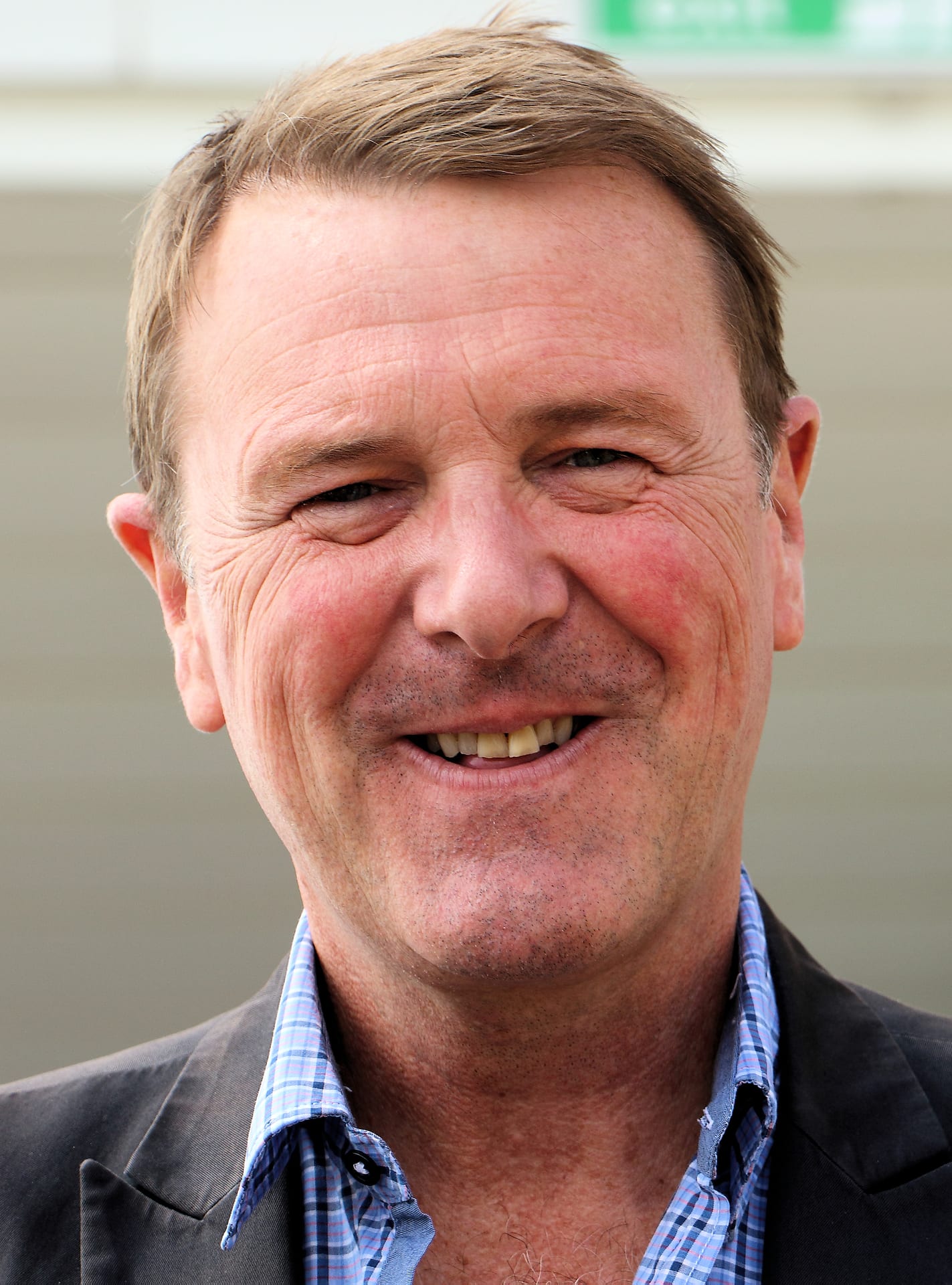 Phil Tufnell - Athlete hair transplant