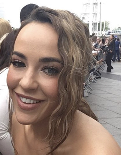 Stephanie Davis - Actor hair transplant