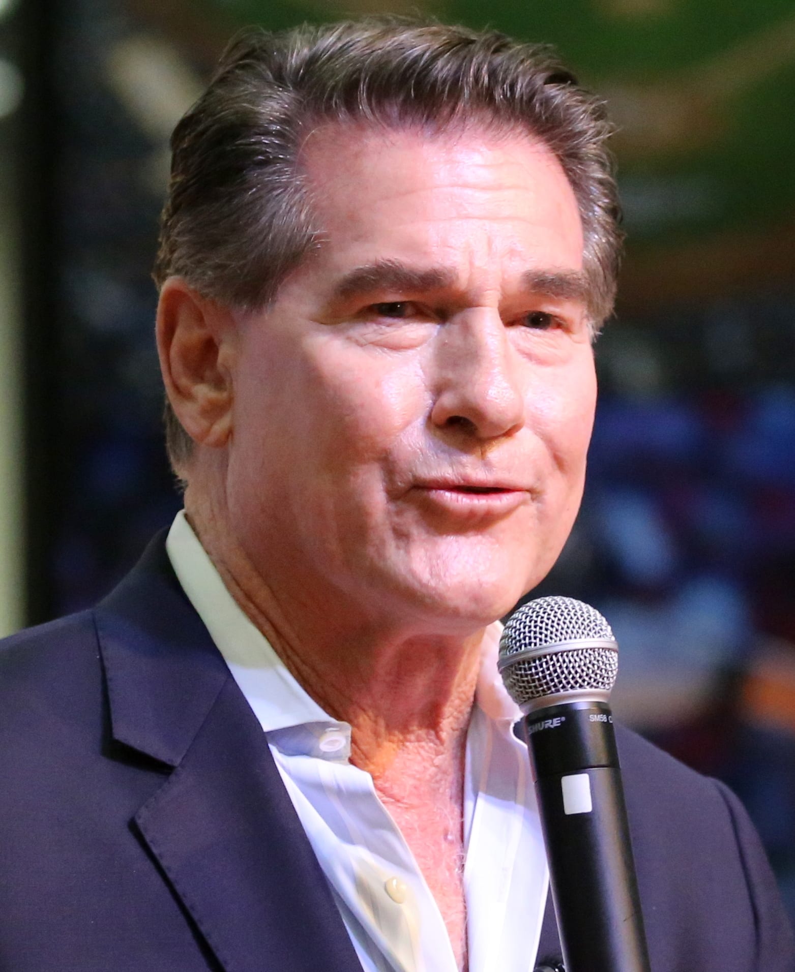 Steve Garvey - Athlete hair transplant