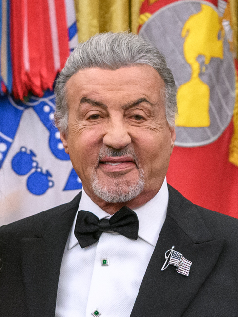 Sylvester Stallone - Actor hair transplant