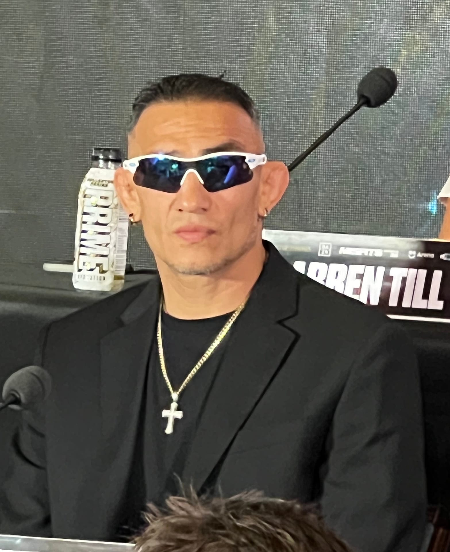 Tony Ferguson - Athlete hair transplant