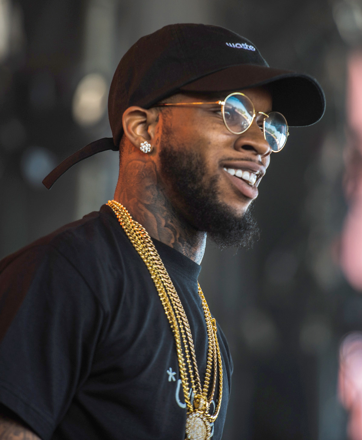 Tory Lanez - Musician hair transplant
