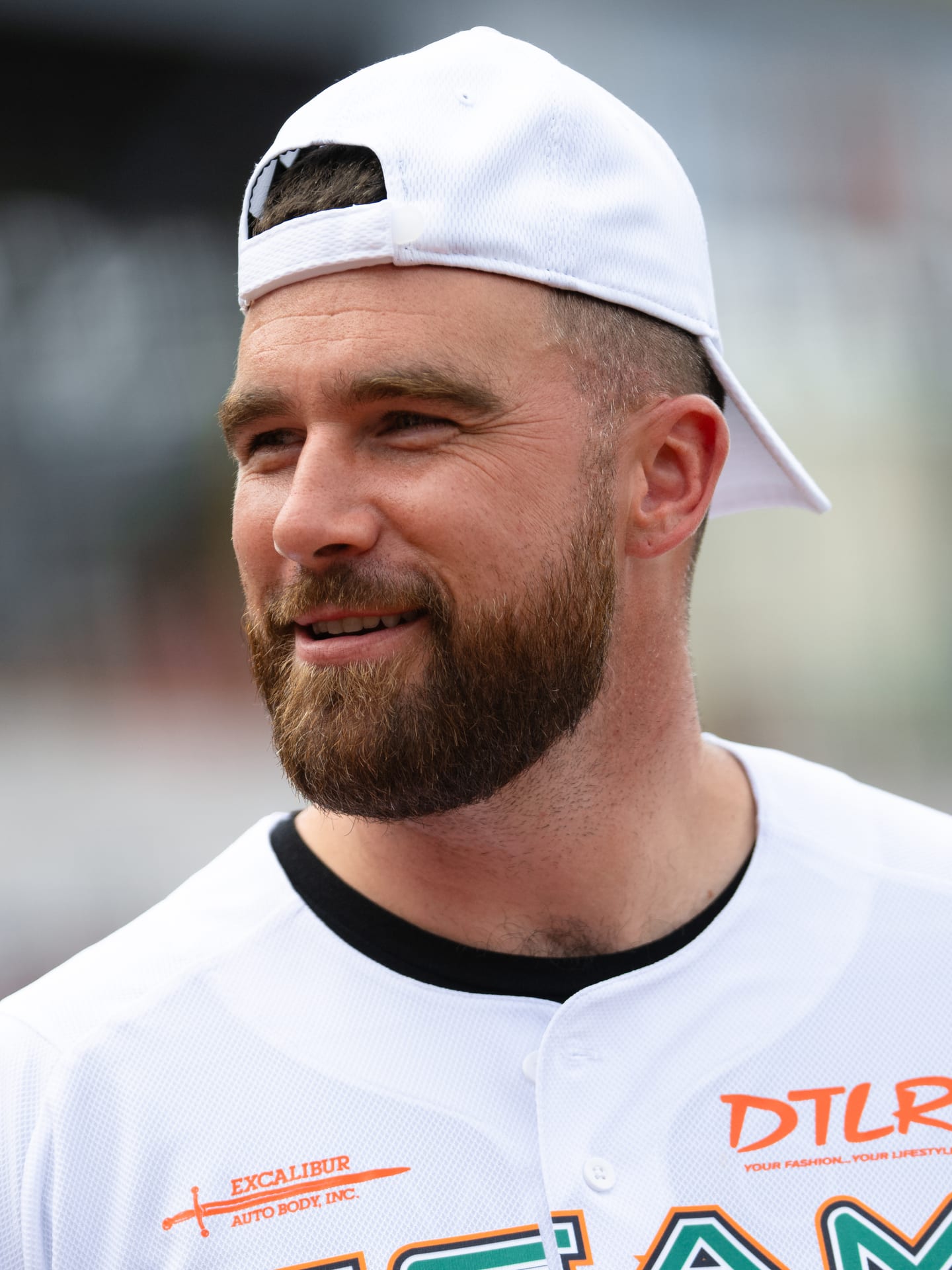 Travis Kelce - Athlete hair transplant